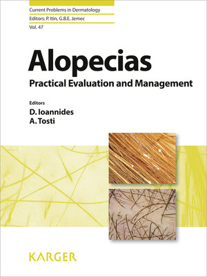 cover image of Alopecias--Practical Evaluation and Management